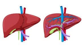 Acinar Cell Carcinoma ribbon